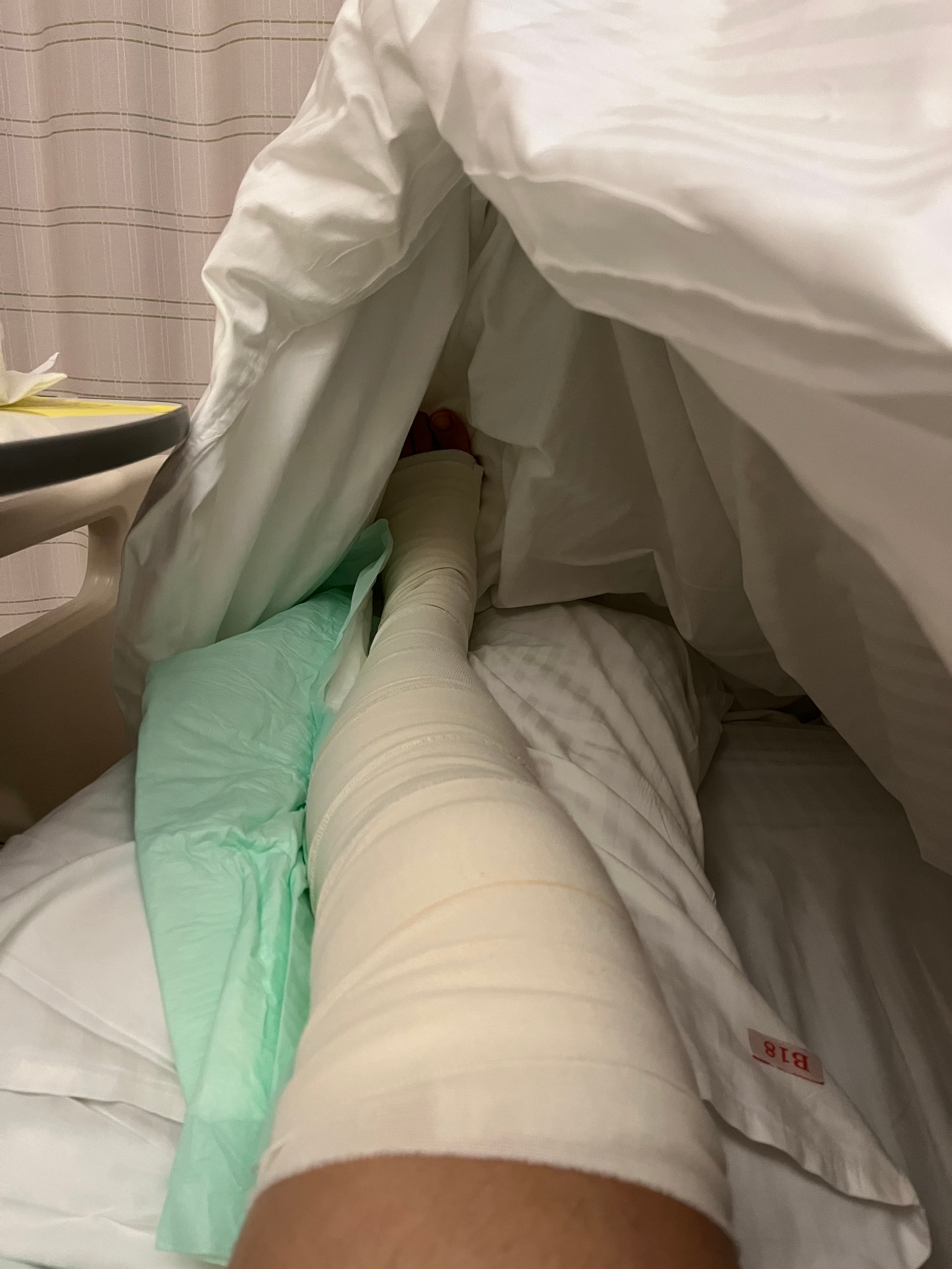 THE ACL TEAR — Surgery, then rehab