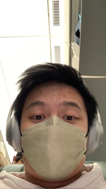 LOTS OF PIMPLES on my face, 2023